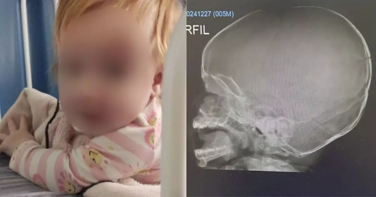 Após queda de bebê em creche, servidoras são afastadas e vereador propõe Lei Maitê em SC