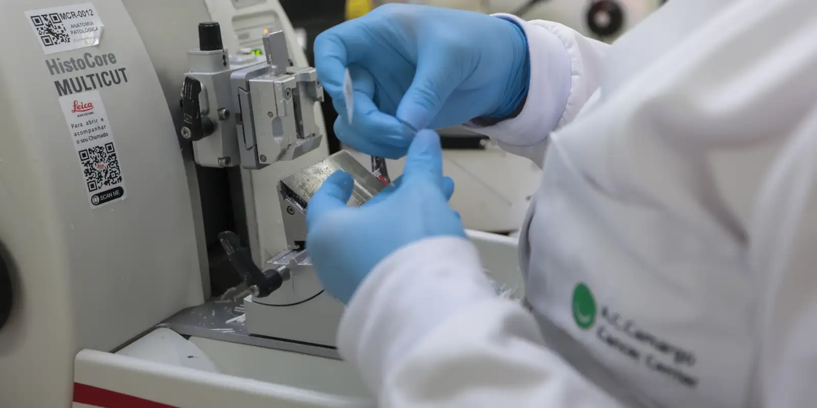 SUS incorpora novo tratamento para leucemia mieloide aguda