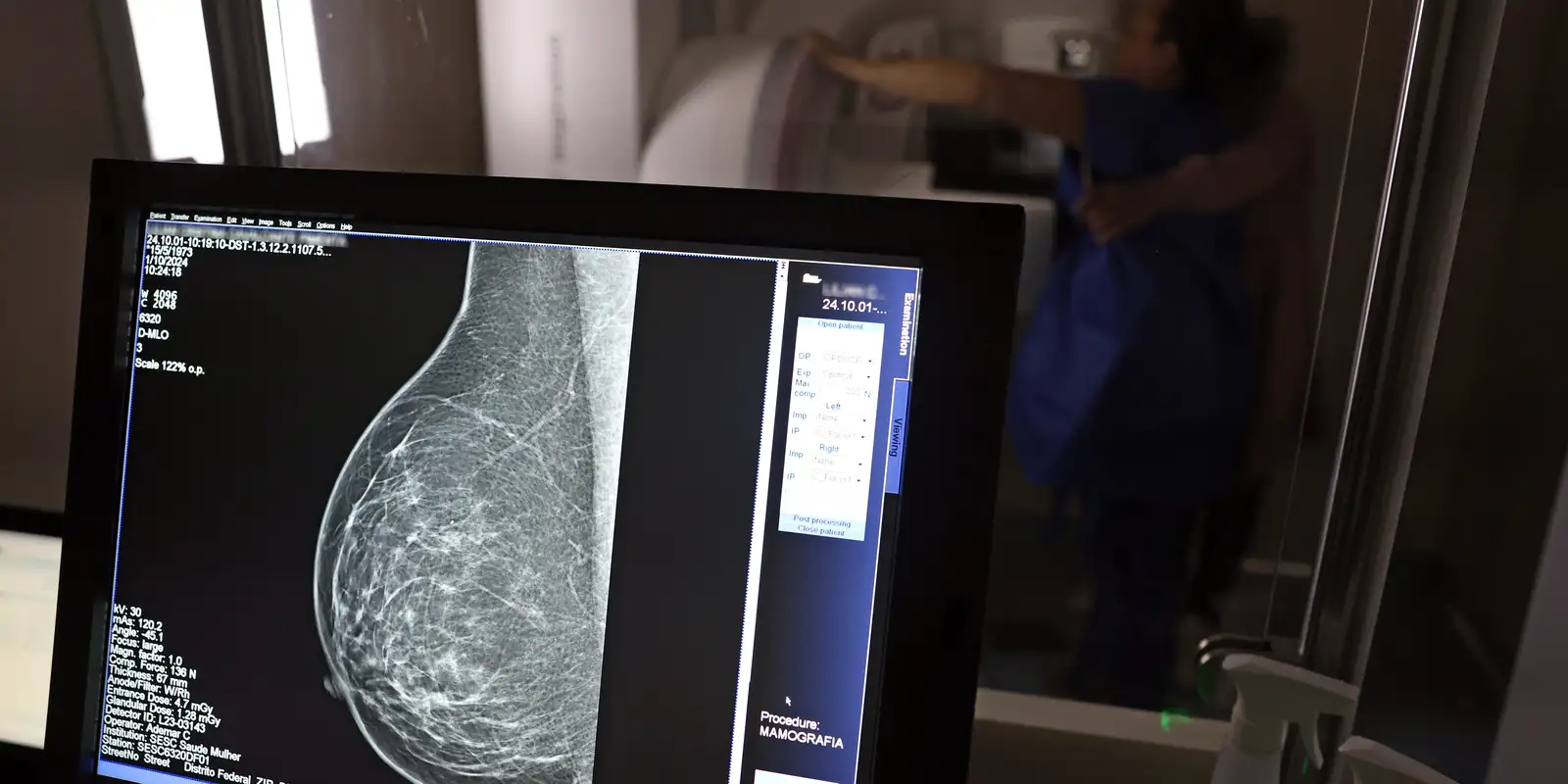Planos de saúde devem cobrir mamografia digital sem limite de idade
