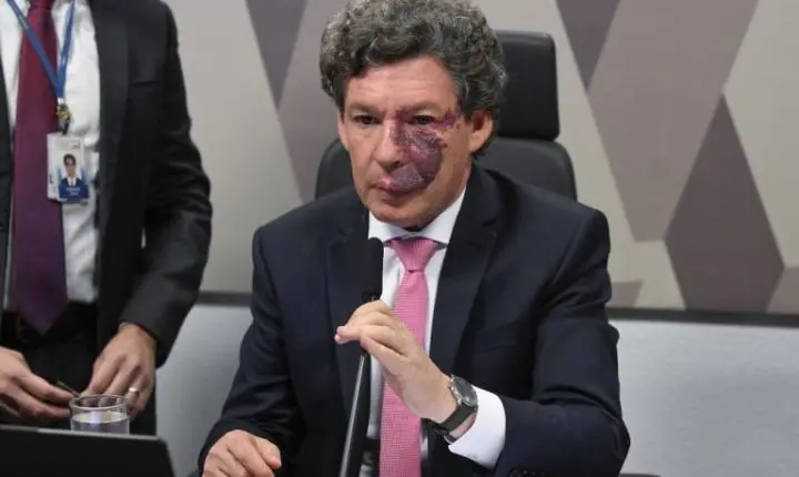 Comissão do Congresso vota nesta terça o fim da taxa das blusinhas